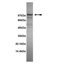Eurofins DiscoverX PKD2 Recombinant Human Protein, Active 10 &mu;g | Buy Online | Eurofins DiscoverX | Fisher Scientific